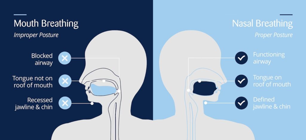 Mouth Breathing vs. Nasal Breathing: Why It Matters for Your Health